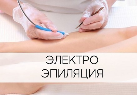 Электроэпиляция Зеленоград